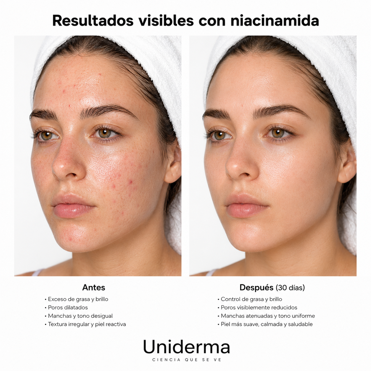 Kit Facial de Niacinamida – Piel Uniforme, Equilibrada y Sin Imperfecciones