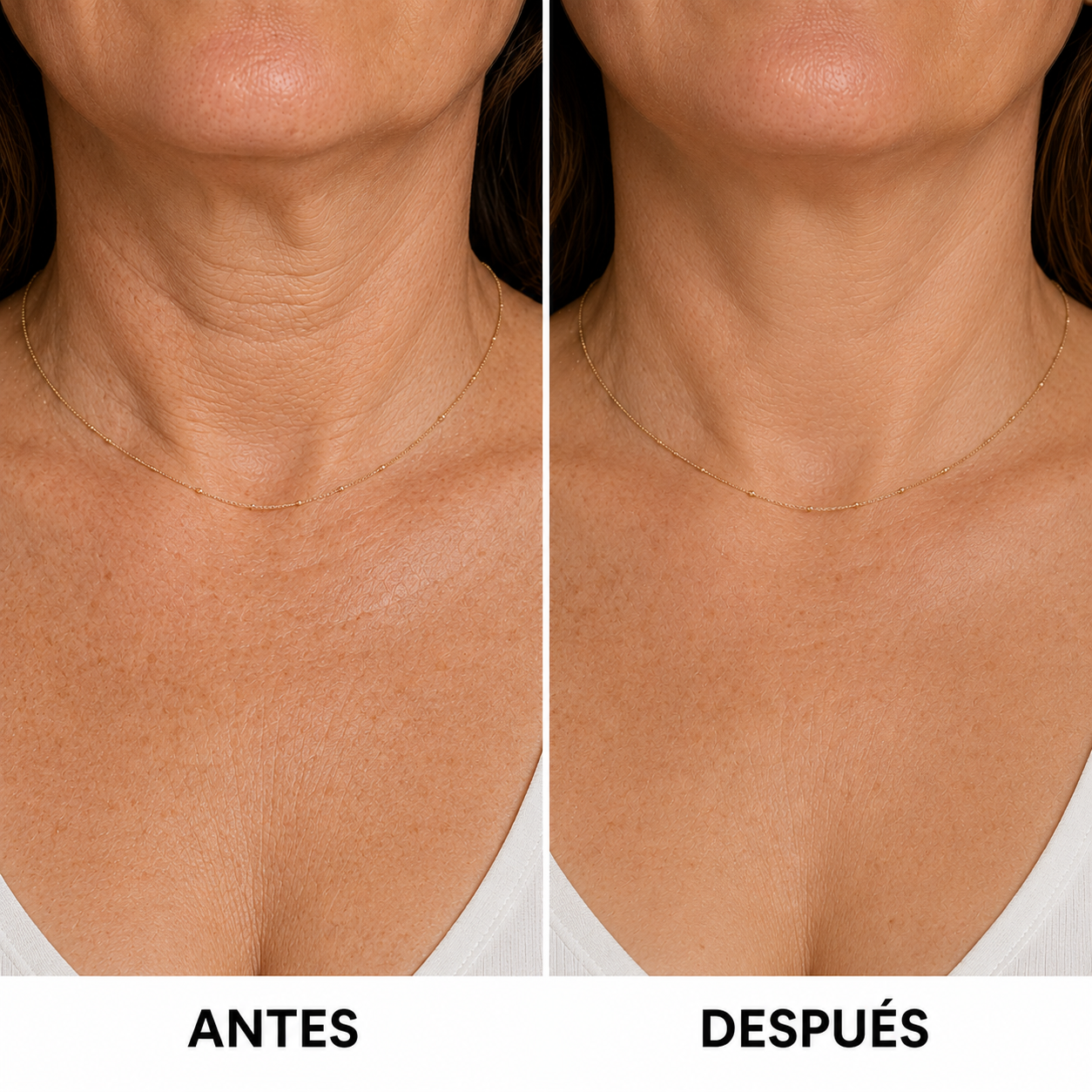 Masajeador Facial EMS Reafirmante Antiage para Papada, Rostro y Cuello