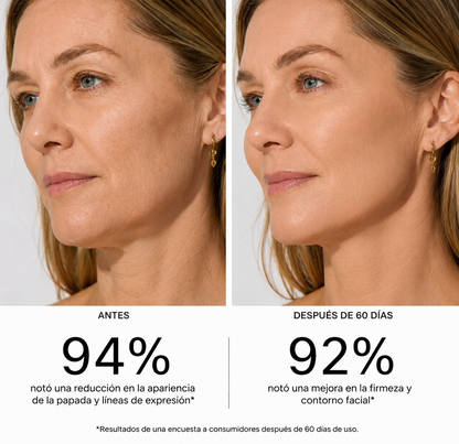Masajeador Facial EMS Reafirmante Antiage para Papada, Rostro y Cuello