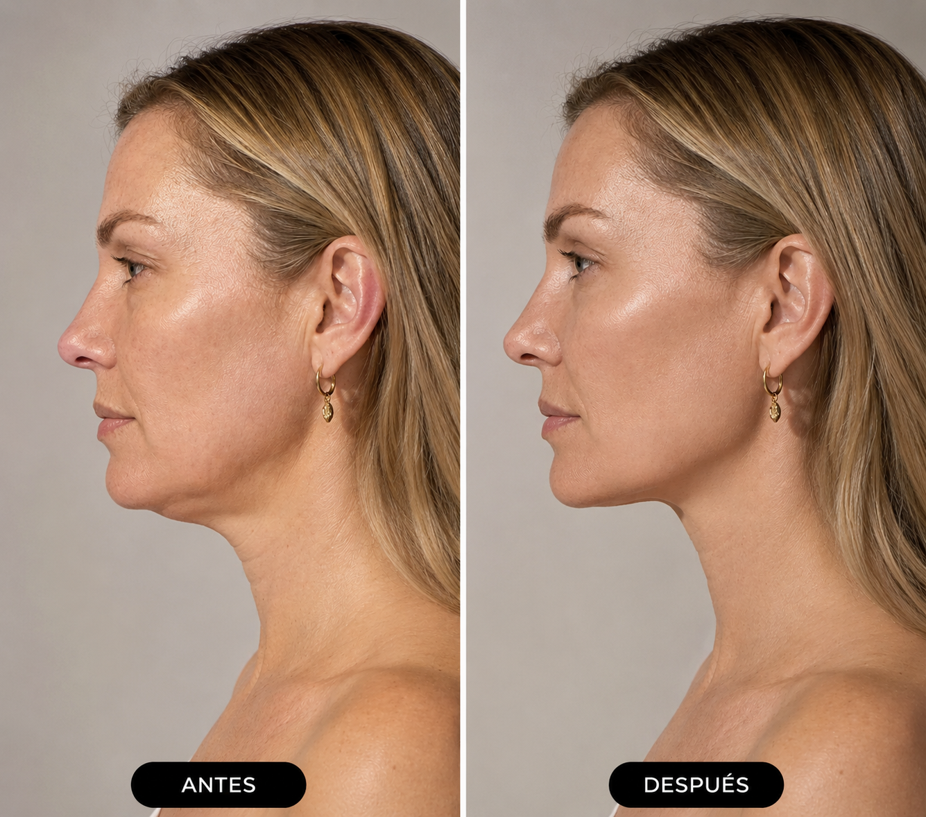 Masajeador Facial EMS Reafirmante Antiage para Papada, Rostro y Cuello