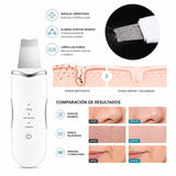 Crema Facial + Sérum + Espátula Ultrasónica Facial de Regalo 4